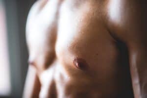 Adult Gynecomastia Surgery Dallas