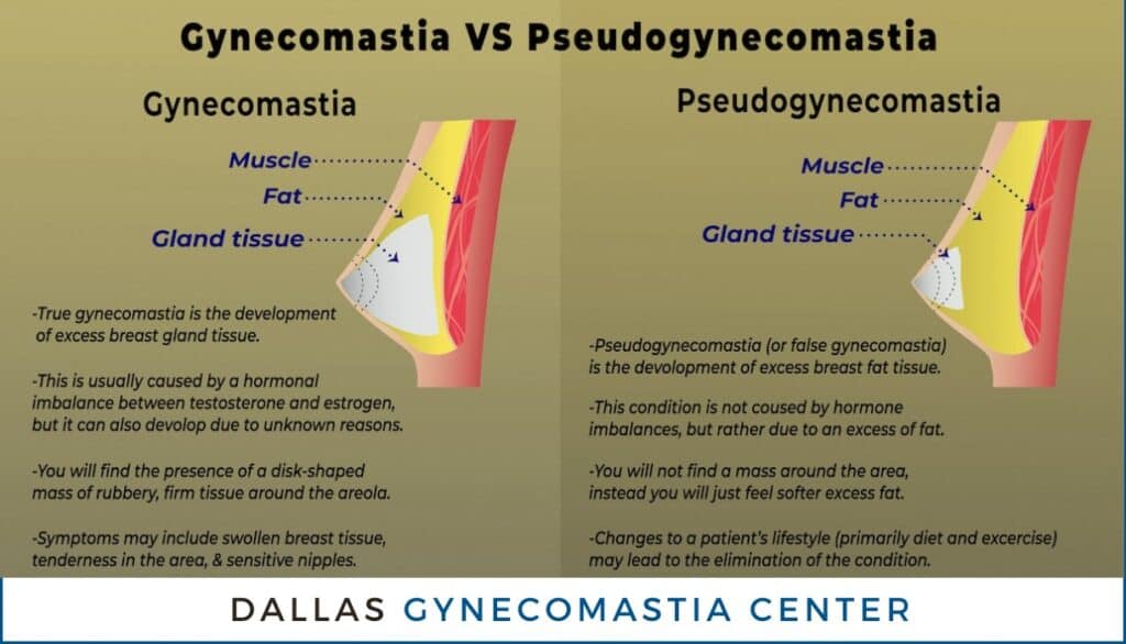 Dallas Pseudogynecomastia Surgery