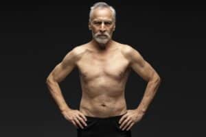 Senior Gynecomastia Surgery Dallas